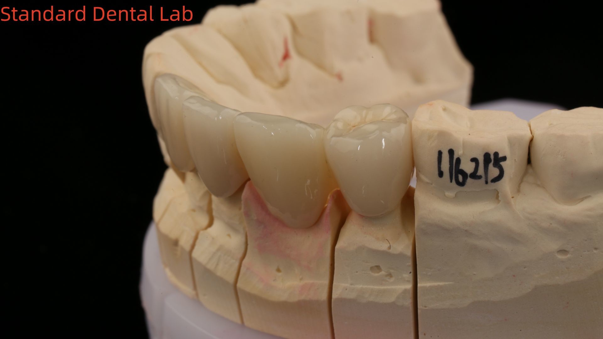 Solid Dental Lab Crowns 3D Pro High Translucency Full Zirconia Crowns with Vita Shade Customized