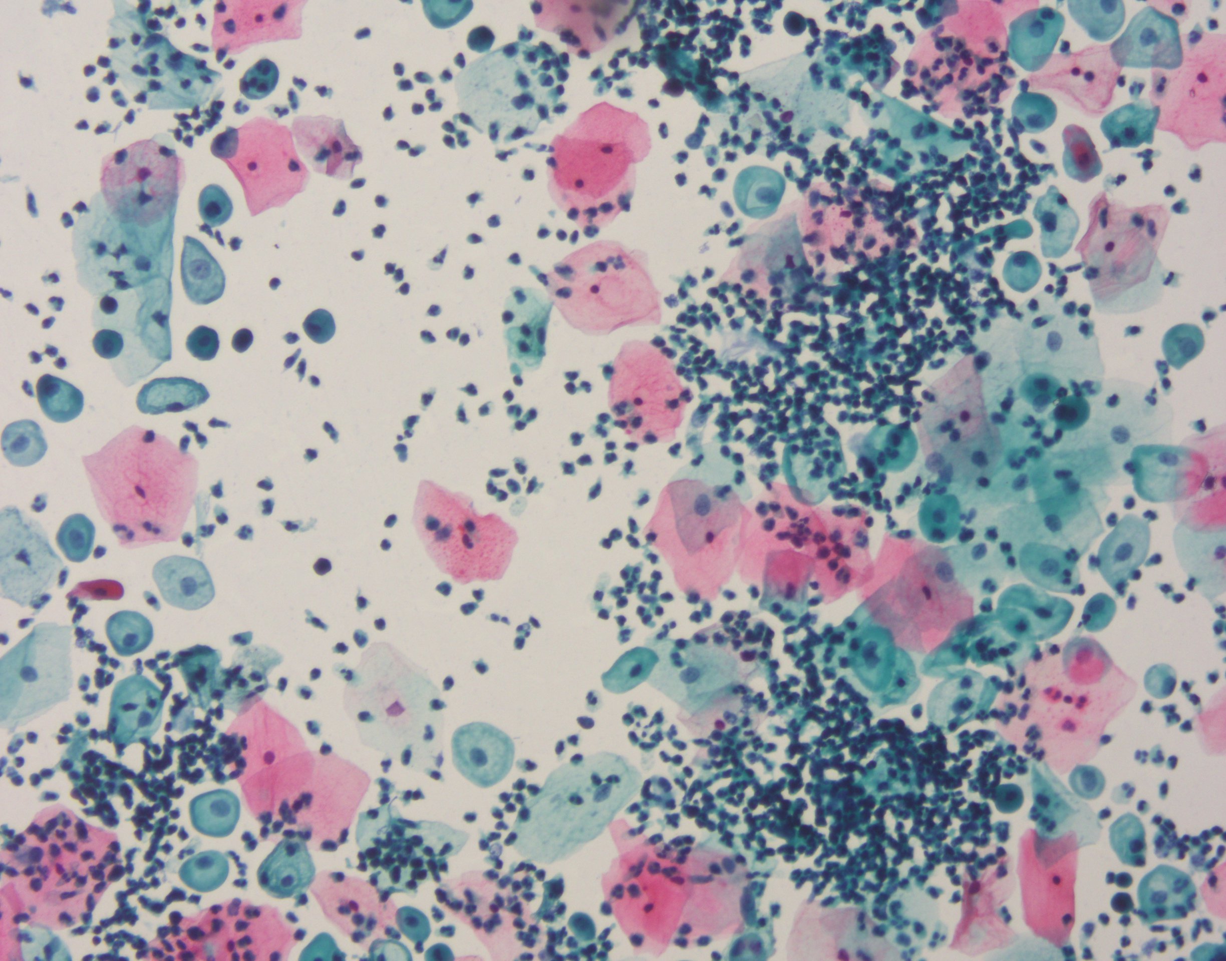 PAPANICOLAOU STAIN EA50 Baso Clear Colourful Stains for Cell Coloring