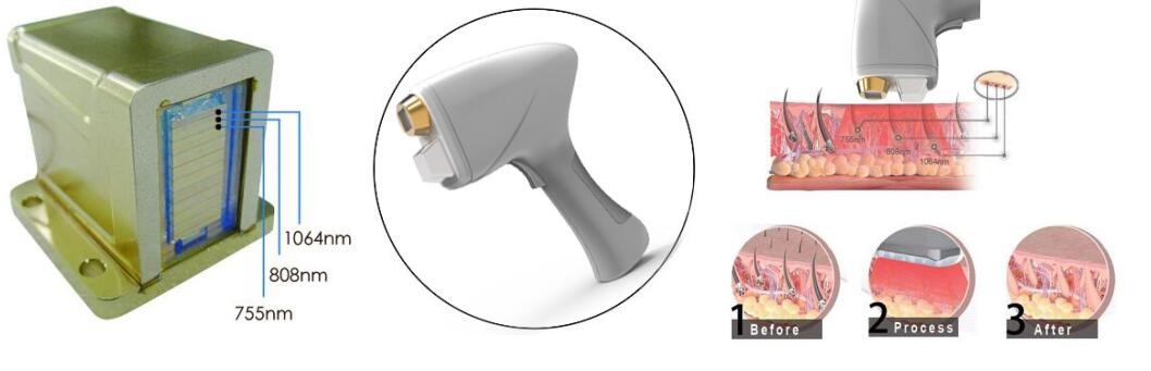 1Hz Beauty Salon Smart 808nm Diode Laser Hair Removal Machine
