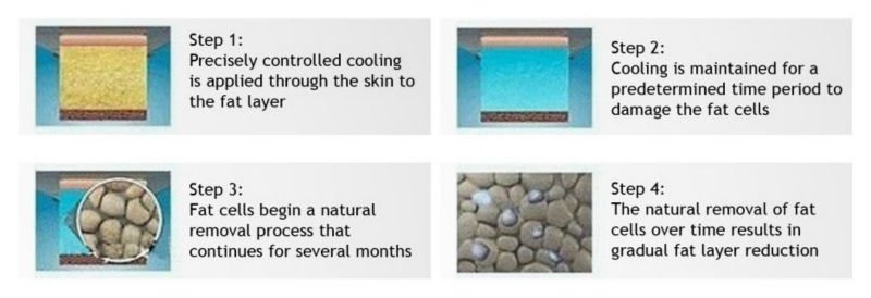 Fat Dissolved cryolipoly Salon machine