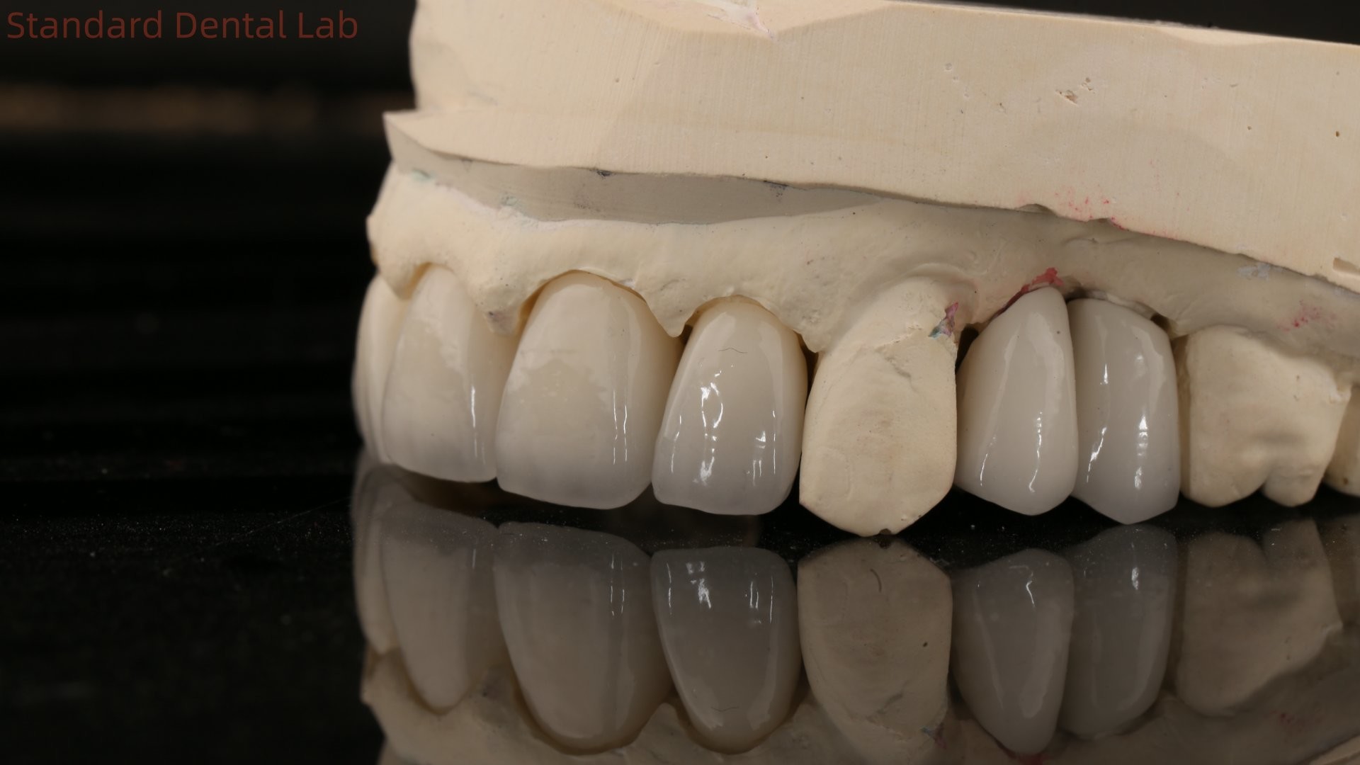 China Dental Lab Zirconia Full Contour Crown High Aesthetic Natural Dental Bridge 5 Year Guarantee