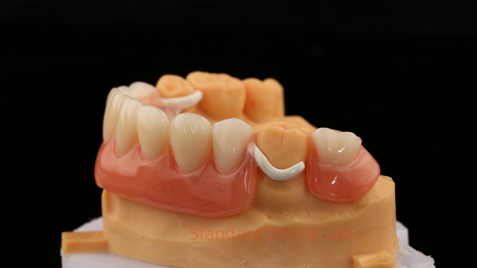 Peek Partial Framework Design ISO CE And FDA Dental Lab Acrylic Partial Denture Framework
