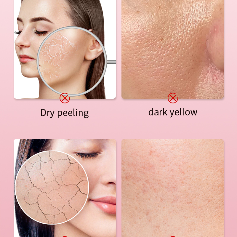 Skin Care Deep Clean Body Lotion Essens Hydrating Nourish Whitening Hyperpigmentation Treatment Skin Care
