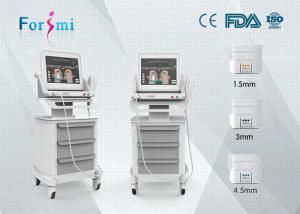  hifu for skin tightening best non surgical face lift machine for sale Manufactures