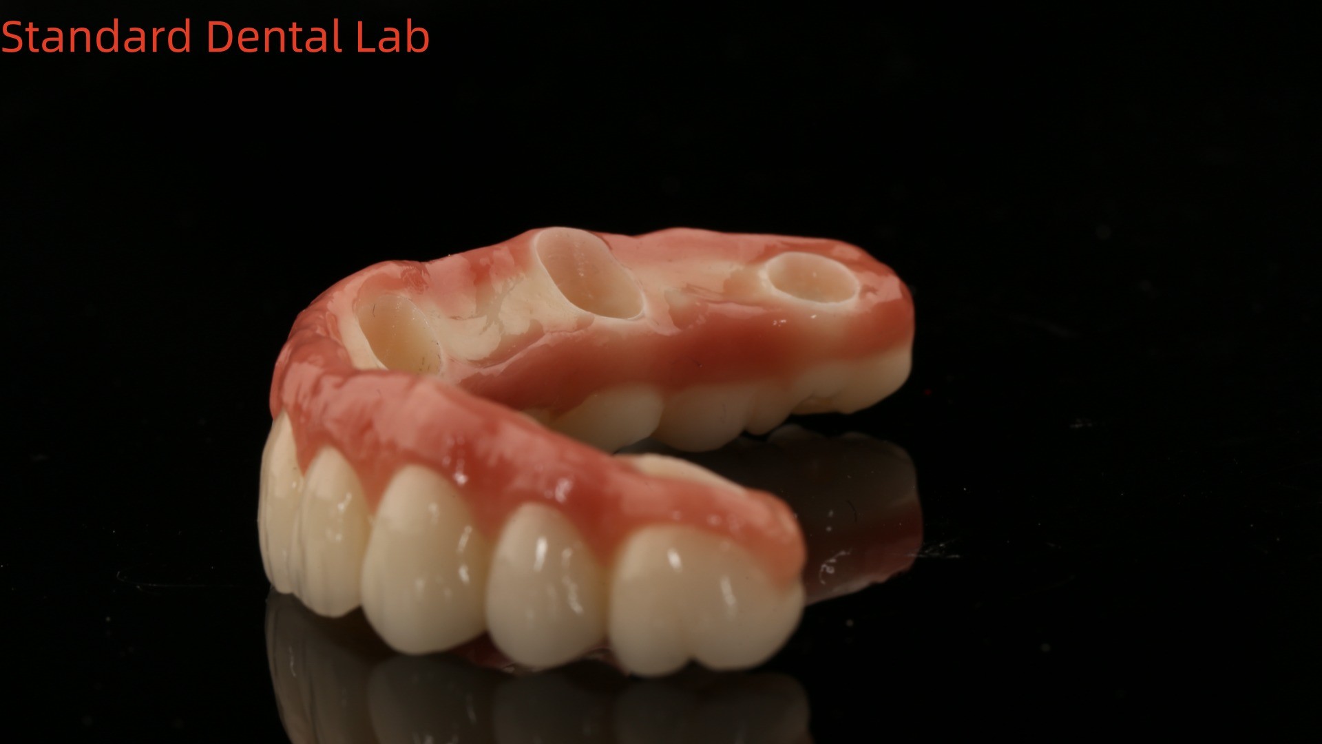 Porcelain All On Four Zirconia Bridge High Esthetics Dental Implant Bridge Screw Retained