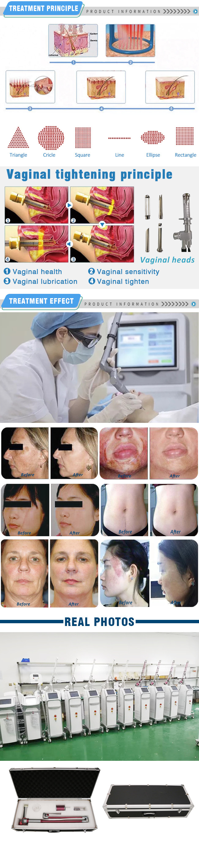 0.1MM Acne Scar Treatment Co2 Laser Vaginal Tightening Laser Treatment For Pigmentation