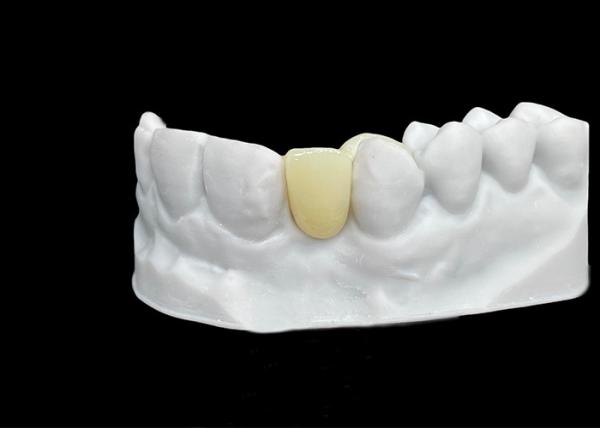 Chipping Resistance Zirconia dental Crown With Exceptional Strength And