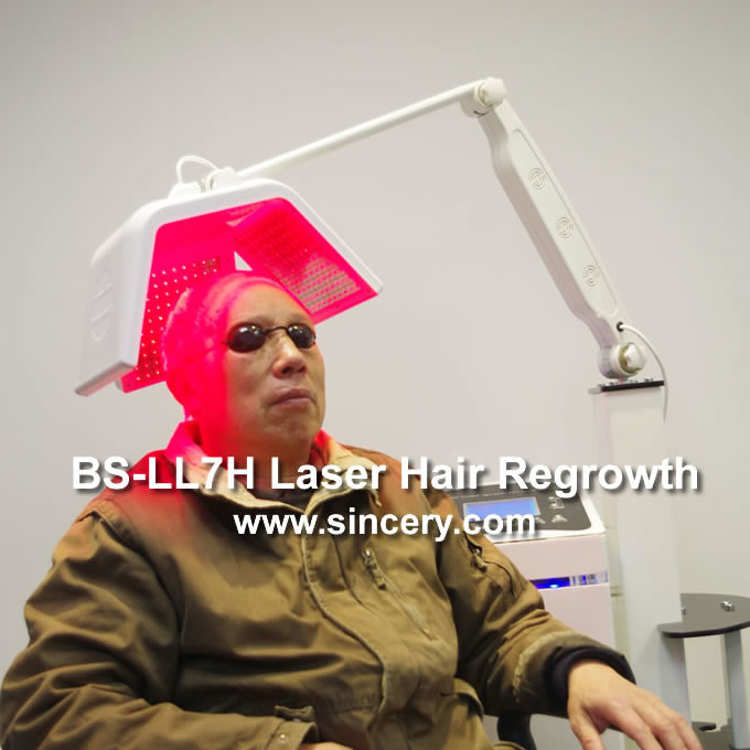 Laser hair regrowth equipment Low Level Diode Laser male female pattern baldness treatment hair regrowth machine