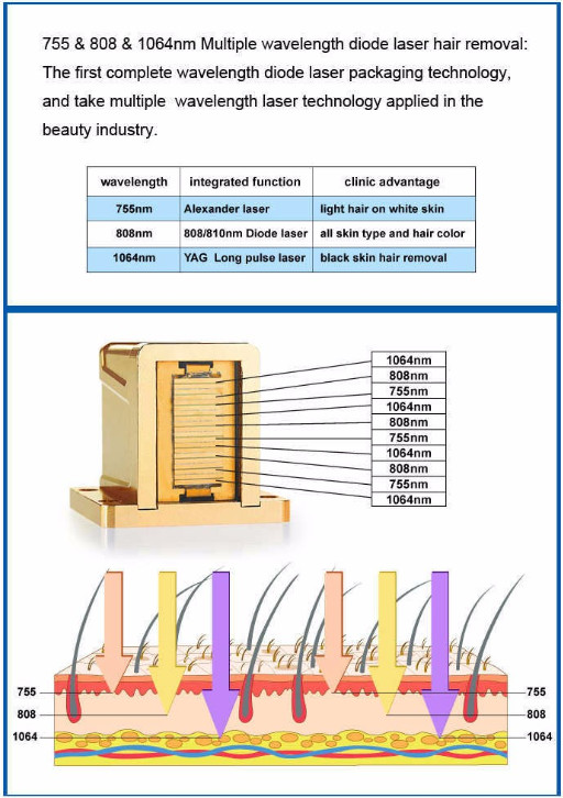 Diode Body Hair Removal 808nm 755nm 1064nm Laser Depilation Machine