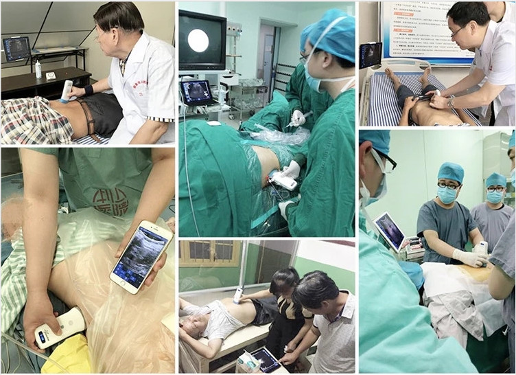 Wireless Ultrasound Tranducer Android Color Doppler Ultrasound Probe Wireless Charging