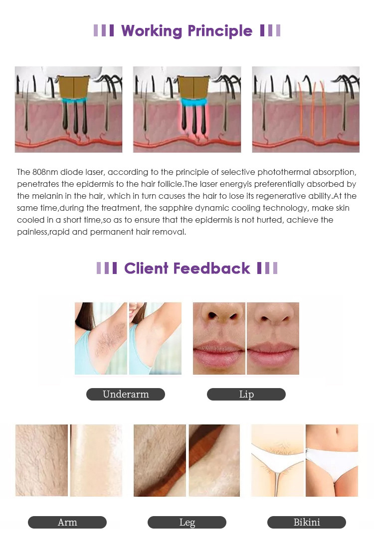 Diode Laser Picosecond Tattoo Removal Machine ND YAG 808 Hair Removal