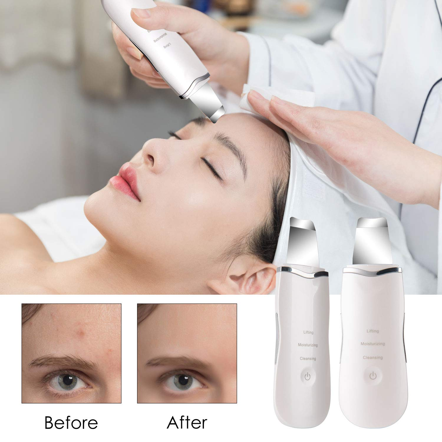 Ultrasonic Skin Scrubber Device