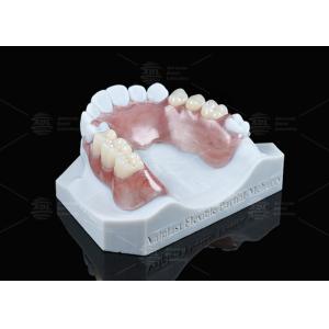 Lightweight Valplast Flexible Partial With Excellent Retention In Pink And