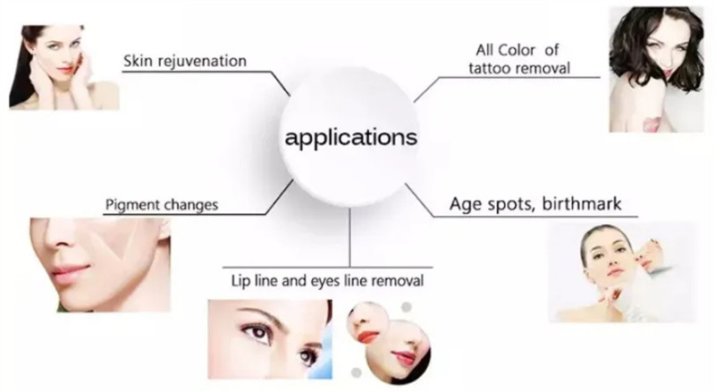 Hot Sales Portable Nd Yag Laser Tattoo Removal Carbon Laser Peel Machine