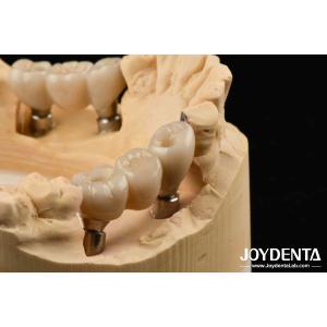 China Zirconia Implants Perfect Match With Natural Teeth Zero Allergy Risk on sale