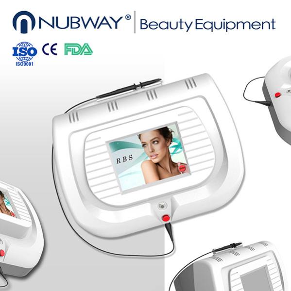 facial treatment ! vascular removalequipment/vascular removalmachine/spider