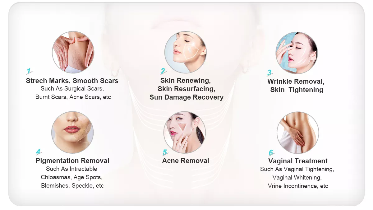 Women medical equipment fractional CO2 laser machine vaginal rejuvenation equipment
