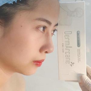  Hyaluronic Acid Injection dermal fillers lip filler Breast Buttock Enhancement Anti Aging Dermal Filler Manufactures