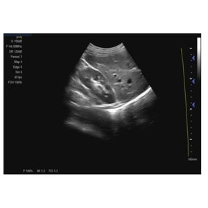 PW Function 2 Probe Connectors Handheld Doppler Machine With Multiple Image