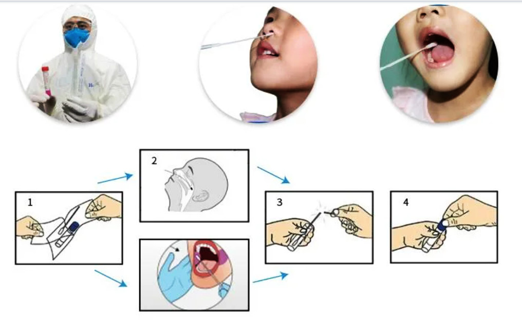 sterile Sampling Swab virus sampling tube with FDA CE certificated