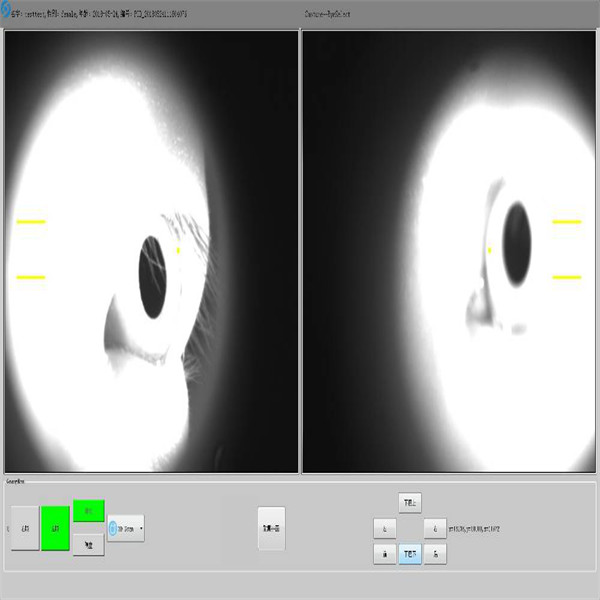 Noninvasive Ophthalmology Oct Machine 2.5mm High Definition Image PC Inside