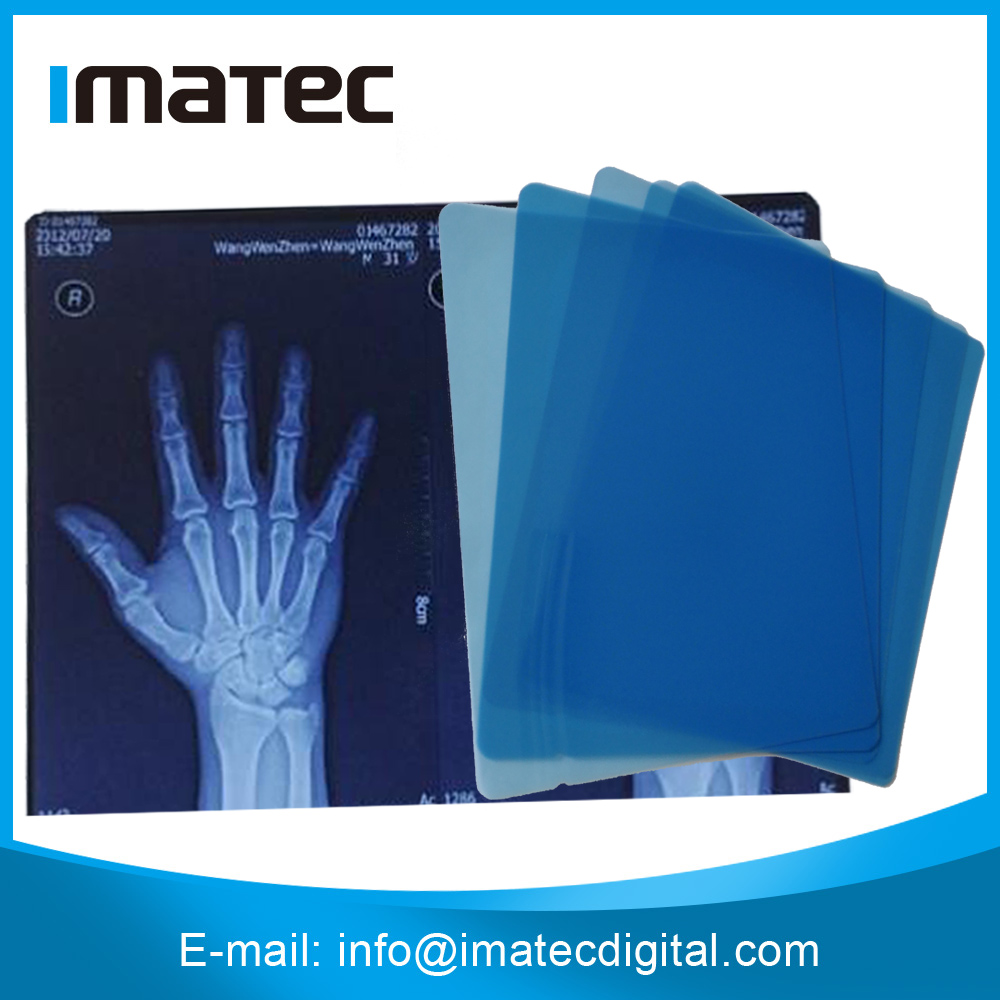 Dry Medical Imaging Blue Base A4 Sheet Inkjet Printing X-Ray Film