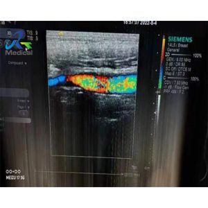 Siemens 14L5 Linear Array Ultrasound Transducer Maintenance Crystal Array And