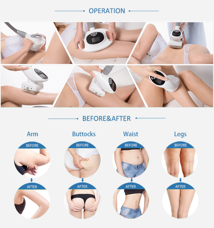 Skin Tightening Vacuum Roller Slimming Machine , RF Laser Body Contouring Machine