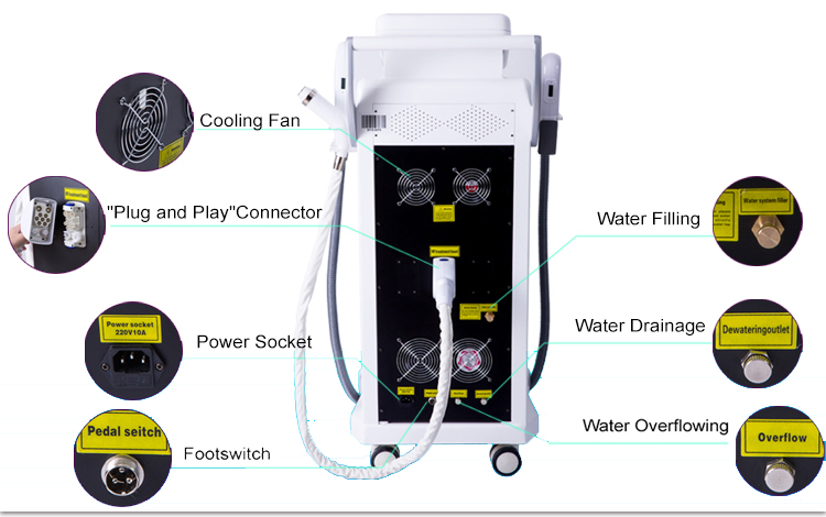 Hair OPT SHR Machine Black Doll Treatment Nd YAG Laser Tattoo Removal