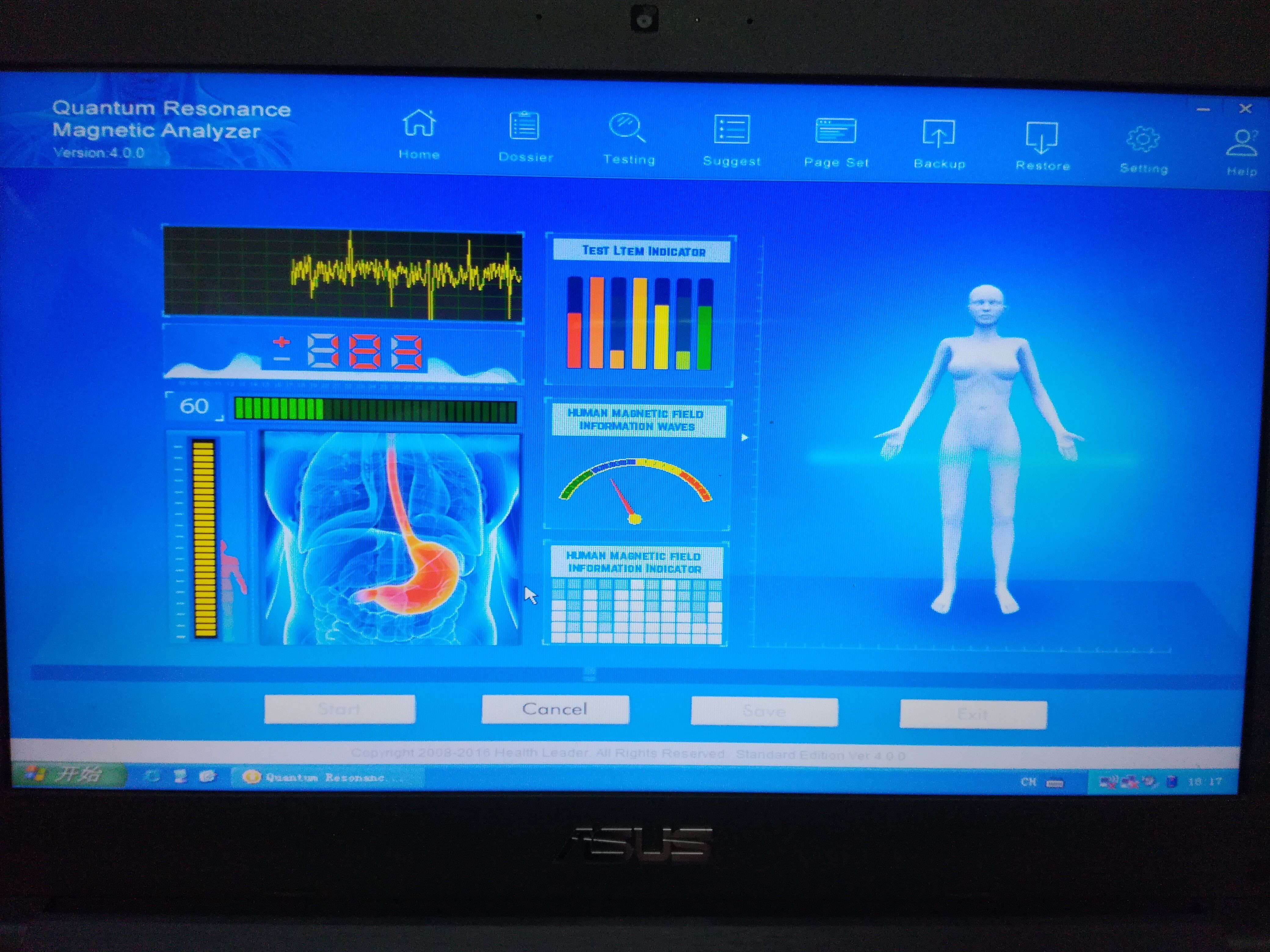 French Quantum Body Health Analyzer
