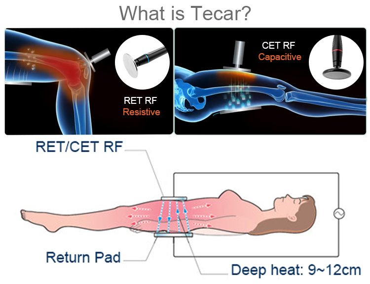 ODM Tecar Therapy Machine Ret And Cet Handles Pain Relieving Machine