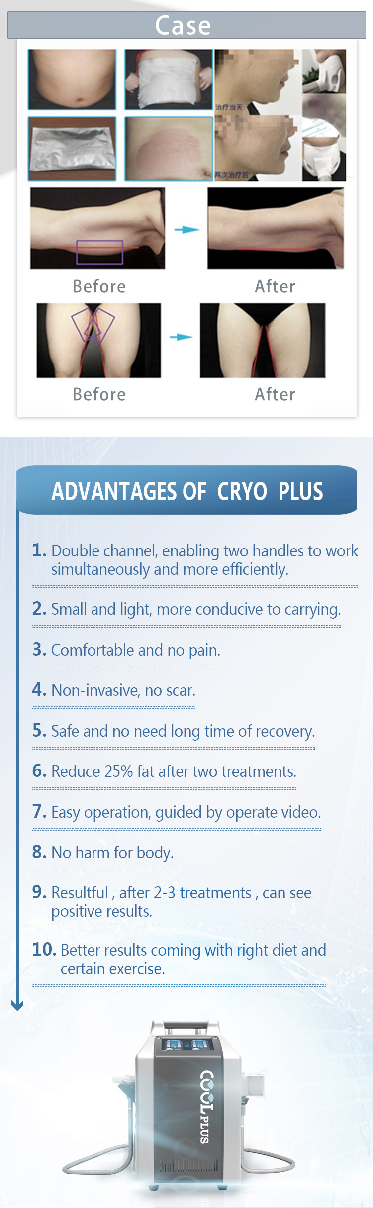 LF-219 Factory Price 4 handles Cryolipolysis Machine/Cool Body Beauty Equipment
