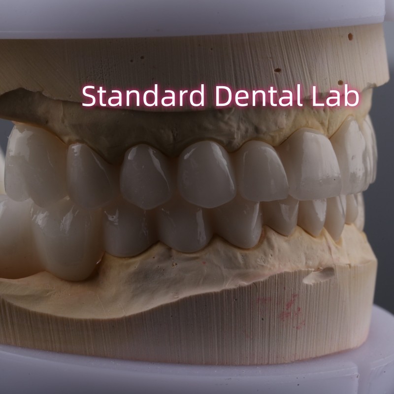 Dental Lab Full Arch Zirconia Porcelain Crowns PFZ Crown ISO FDA CE