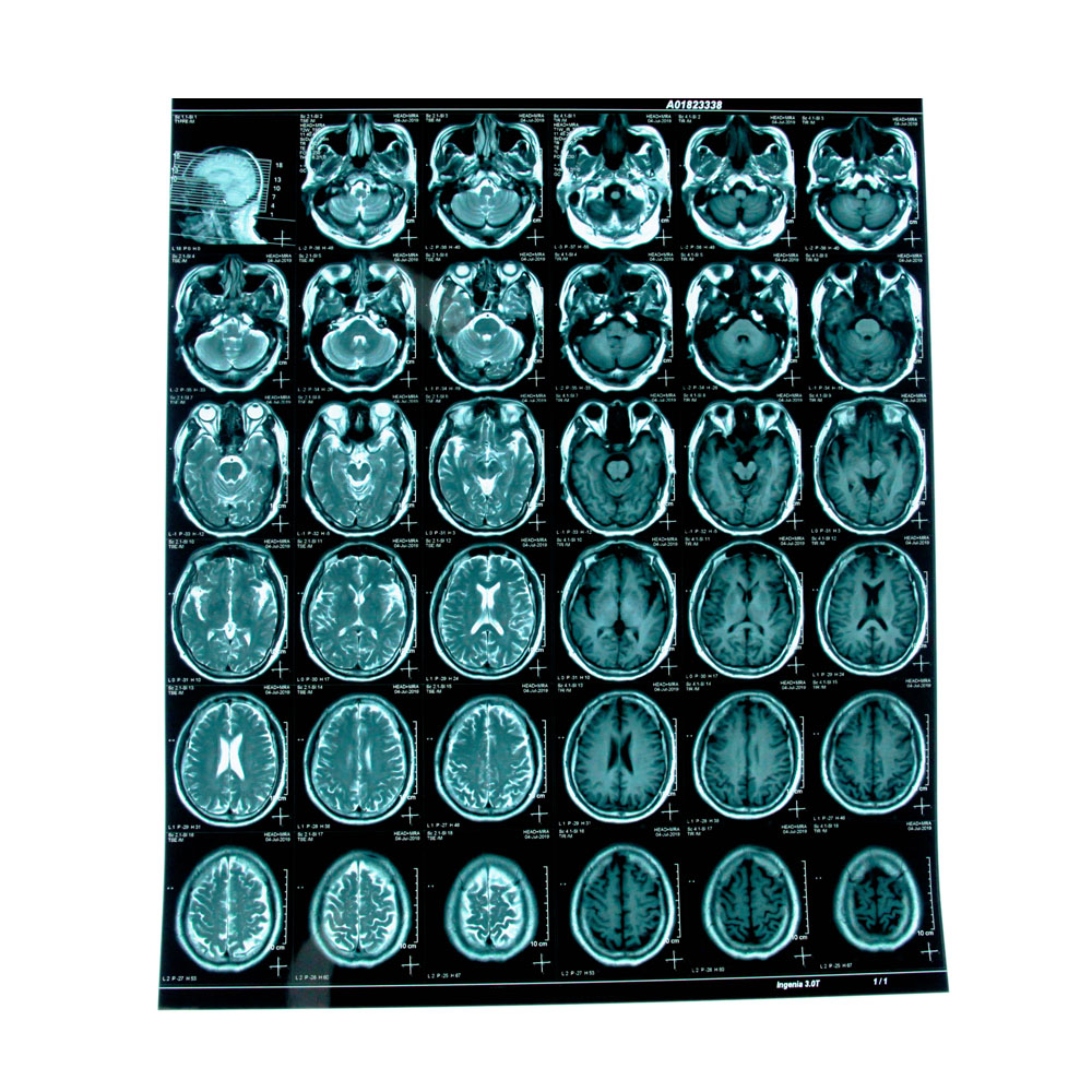Blue Inkjet Medical X Ray Film Medical Dry Film A4 A3 Sheets Or In Rolls
