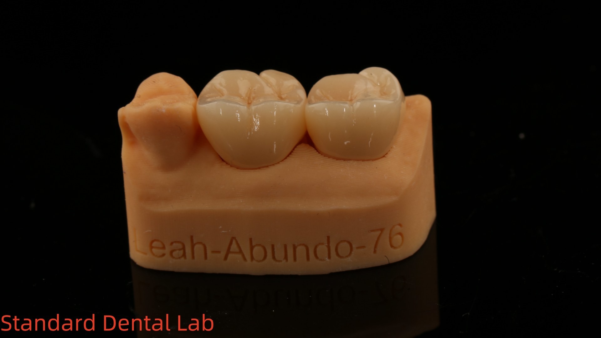 Solid Dental Lab Crowns 3D Pro High Translucency Full Zirconia Crowns with 5-Year Guarantee