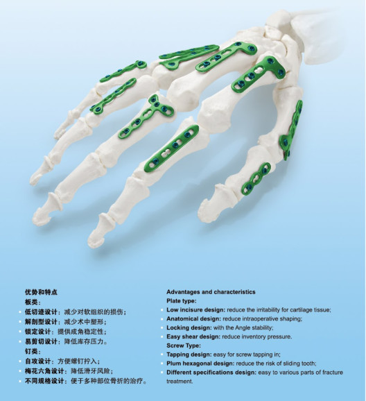 Phalange Orthopedic Titanium Mini Plate And Screw L Shaped 4 5 6 Holes