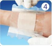 5*10 cm Advanced Hydrocolloid wound dressing with thin border