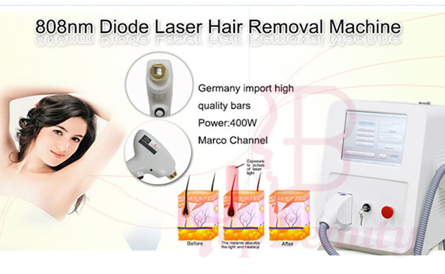 Intelligent Hair Removal Ice Cooling 808nm Diode Laser Machine