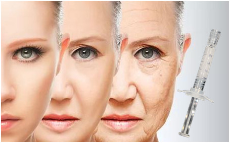Polycaprolactone Hyaluronic Acid Serum Collagen Rejuvenation PCL Injection Filler