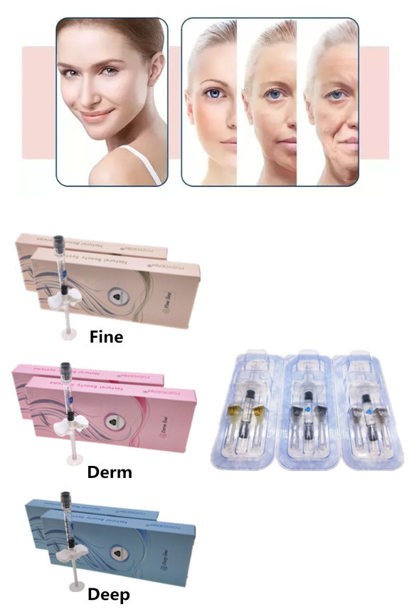 1ml 0.3% Lidocaine Lip Filler Hyaluronic Acid Injection