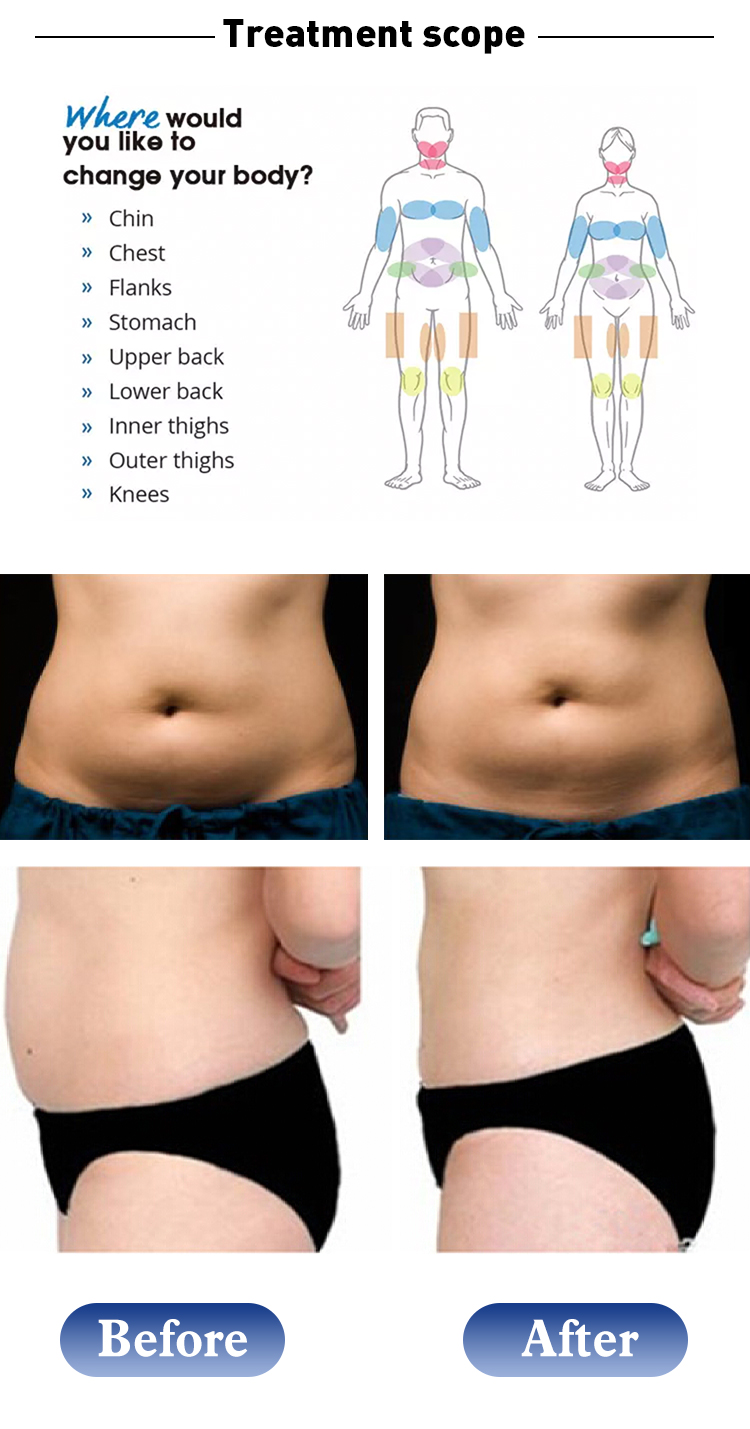 1060nm Diode Laser Non-Invasive Body Sculpting Machine for Fat Reduction and Slimming