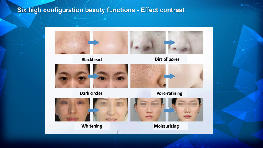Professional Smart Multifunction Aqua Peel Water Dermabrasion Machine for Beauty Salon Use