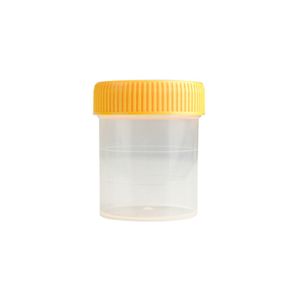 Plastic Disposable Medical Sterile Sample Specimen Collection Stool Urine
