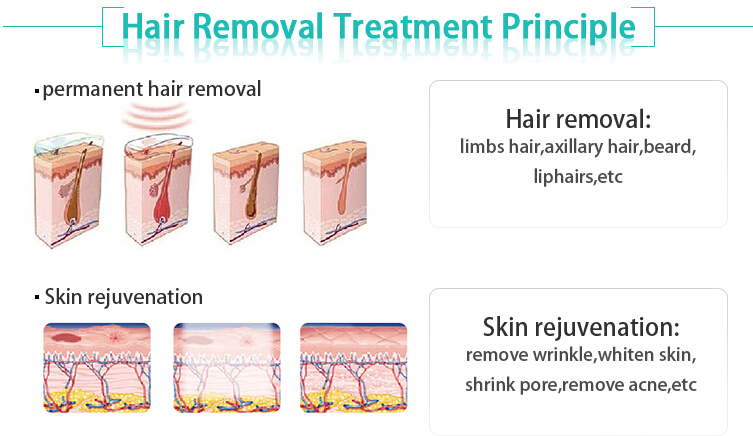 3 strong cooling system 3000W big spot size intense pulse light hair removal machine 