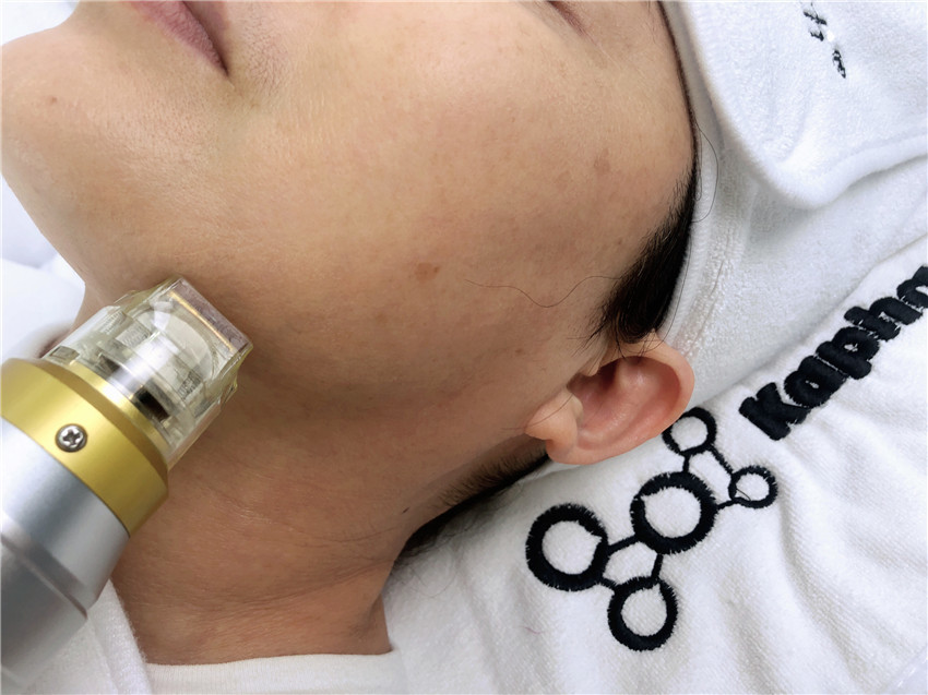 Thermal Cooling 10.4 Inch Microneedling Fractional RF Face Lifting