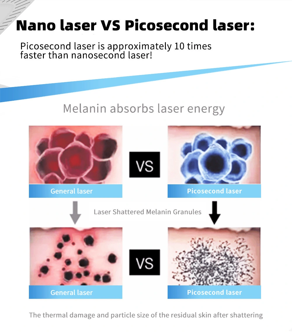 2023 Picosecond Pico Laser Tattoo Removal Machine 1064 532nm Q-Switched ND YAG