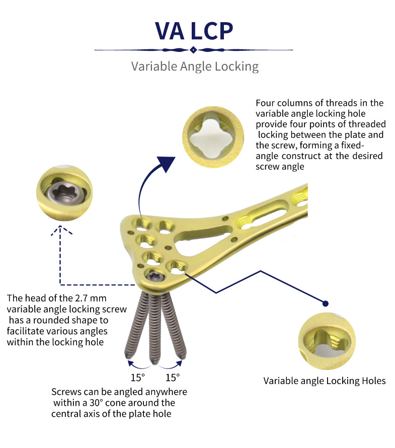 Trauma Multi Axial Palm Distal Radius Fracture Plate II