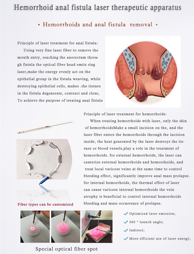 Hospital Vascular Removal Diode Laser 980 1470 Nm Hemorrhoid Machine