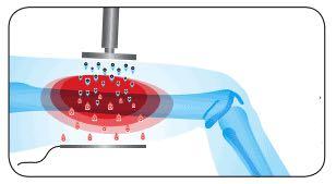 RF Tecar Microwave Diathermy Equipment For Muscle Relax
