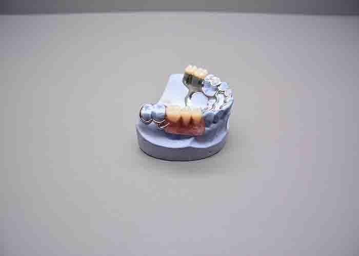 Lightweight Partial Denture Materials Nickel Chrome Casting Metal Both 1kg/Bottle